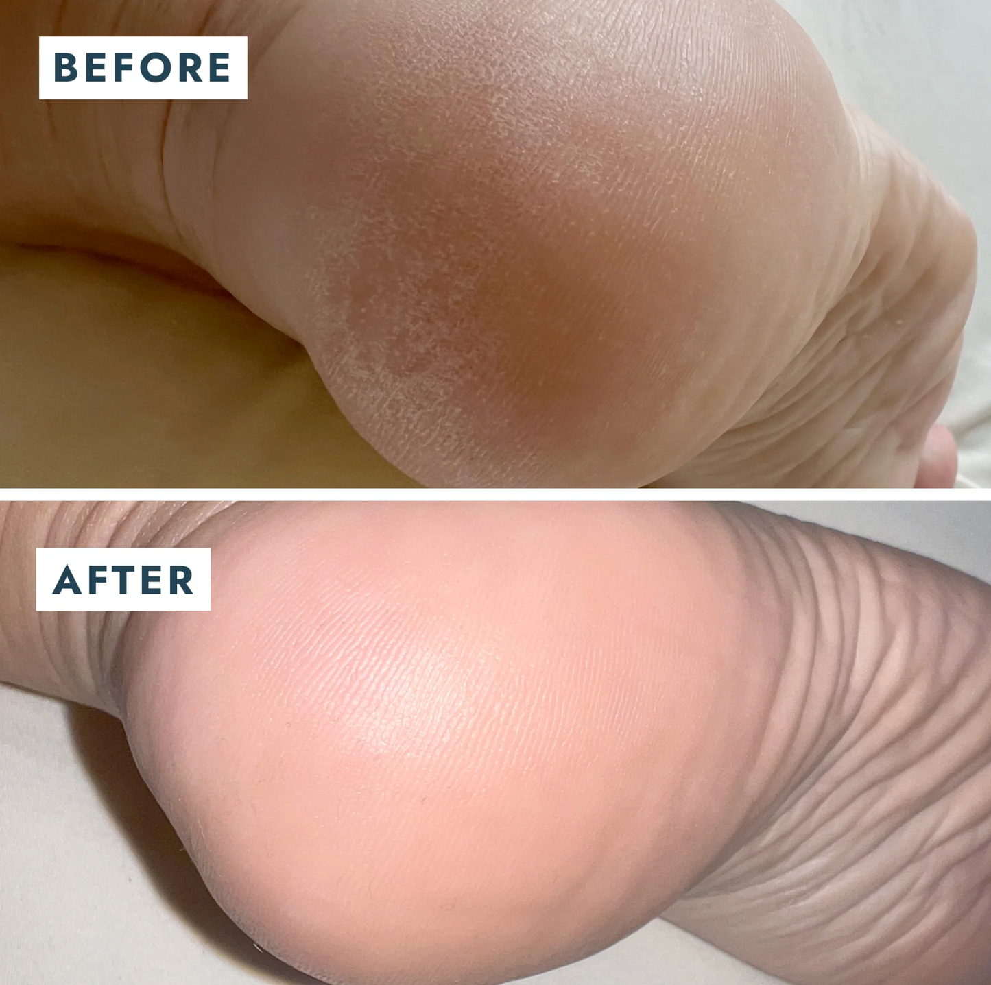 Voesh Solemate Heel Repair - Mint
