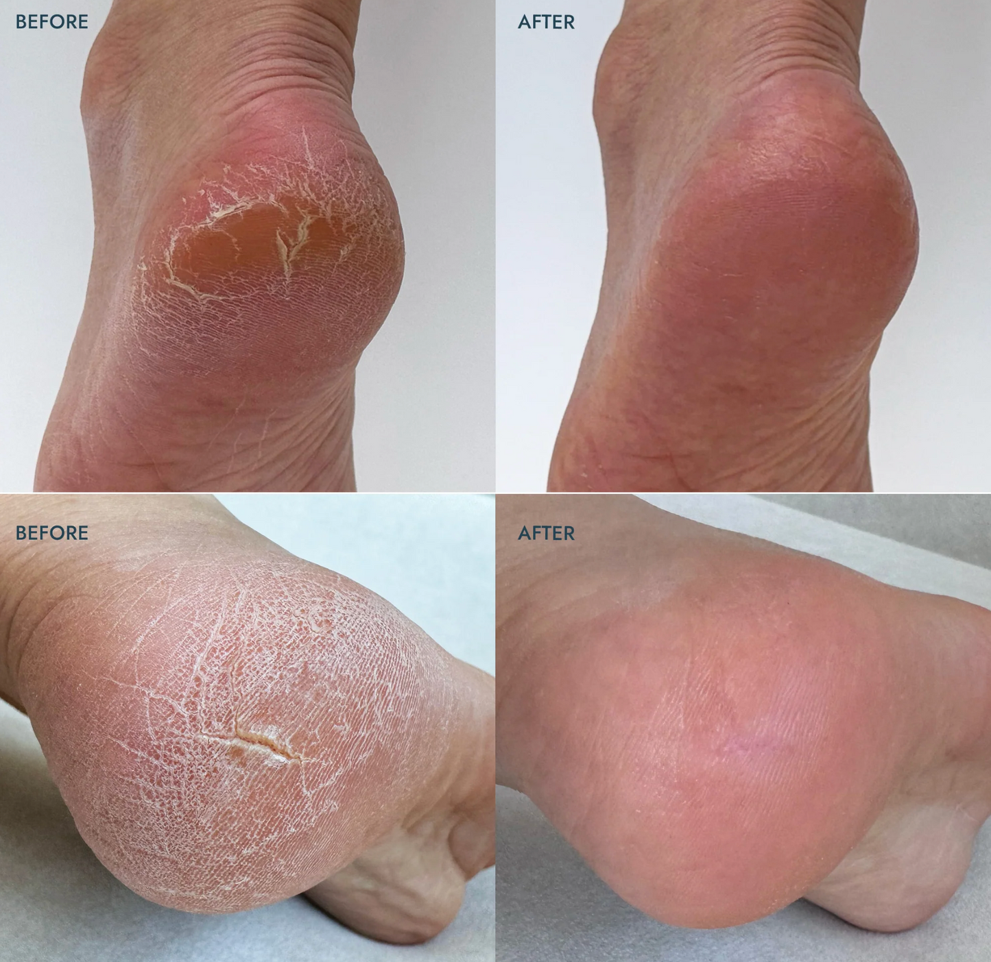 Voesh Solemate Heel Repair - Lavender